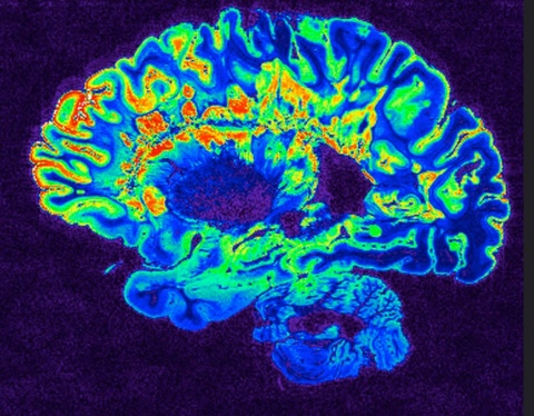 NIH Brain Scan Image