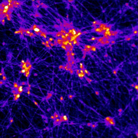 NIH nerve cells