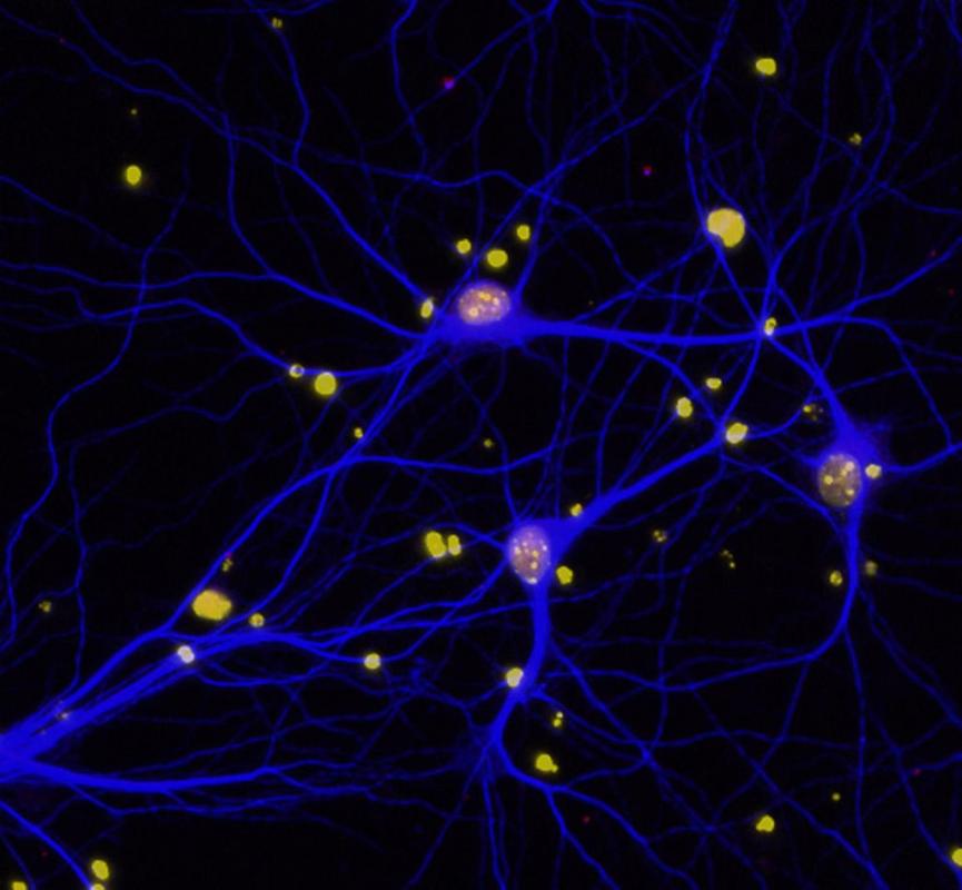 neurology_nih_alzheimers