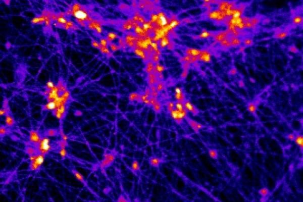 NIH nerve cells