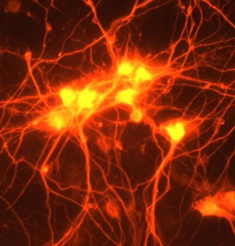 NIH Brain Neurons Orange