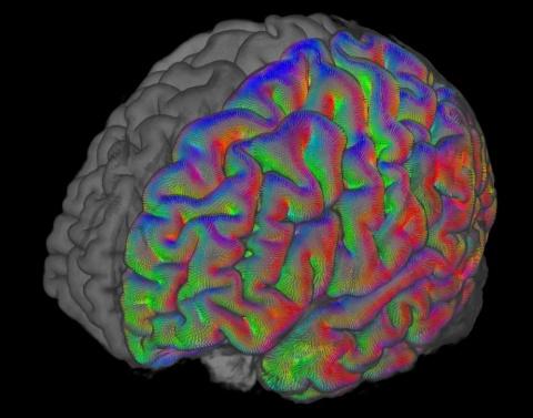 Colorful Brain Scan - Iain Bruce Lab