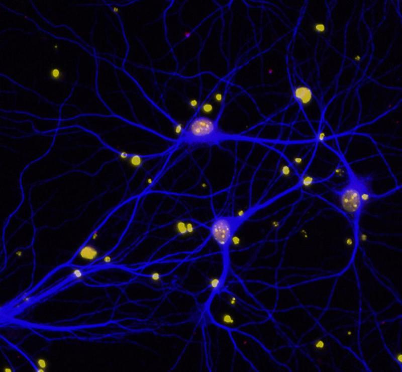 neurology_nih_alzheimers