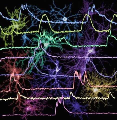 NIH EEG Image