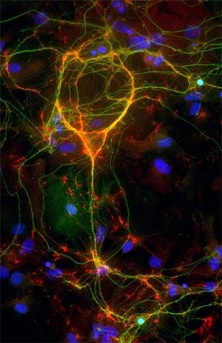 NIH Interneuron Image