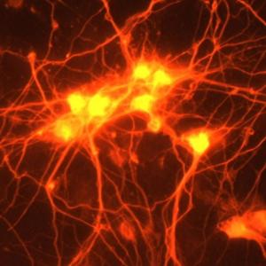 NIH Brain Neurons Orange