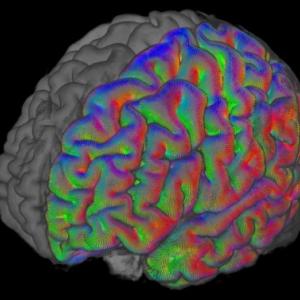Colorful Brain Scan - Iain Bruce Lab