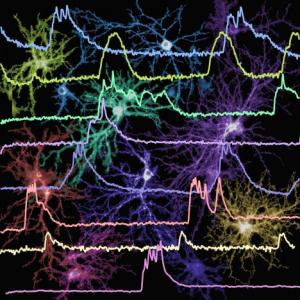 NIH EEG Image