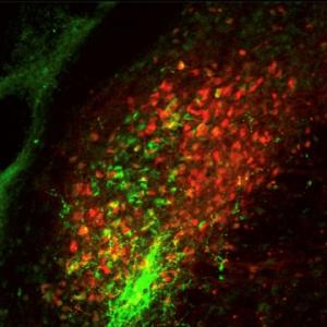 NIH Neuron Image