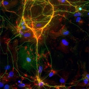 NIH Interneuron Image