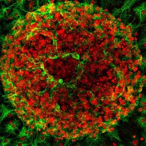 Astrocyte courtesy NIH